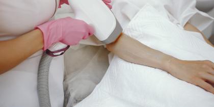 LHR : Laser Hair Removal